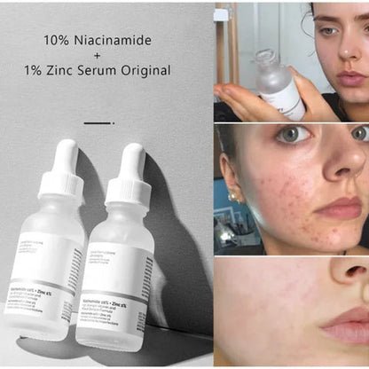 Buy 1Get 1Free Ordinary Niacinamide 10%+Zinc 1% 30ml (Pack 2)
