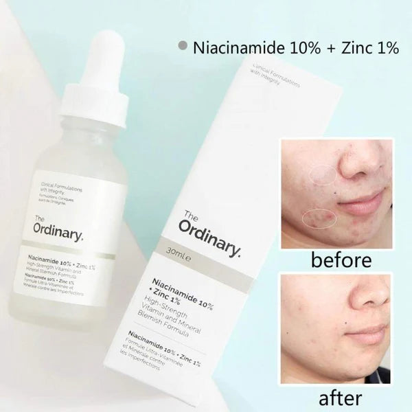 Buy 1Get 1Free Ordinary Niacinamide 10%+Zinc 1% 30ml (Pack 2)