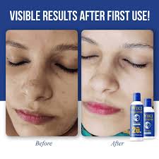 Deal Wiki Special Skin Polish & 24K Gold Whitening Formula